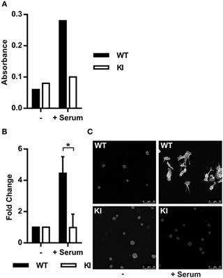 A β2-Integrin/MRTF-A/SRF Pathway Regulates Dendritic Cell Gene Expression, Adhesion, and Traction Force Generation